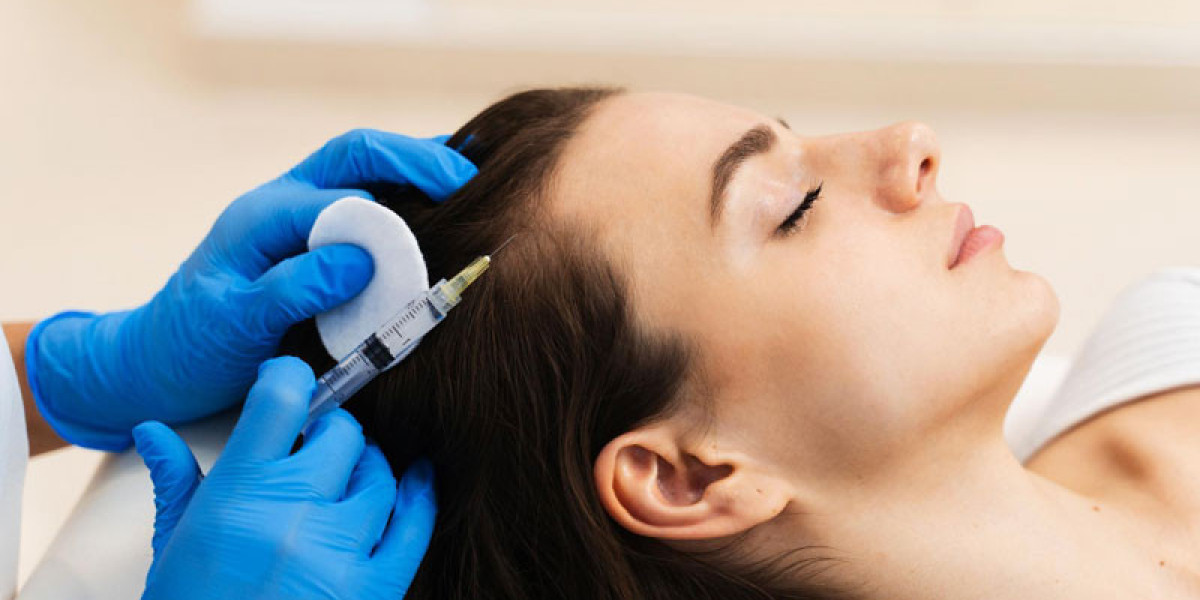 PRP Hair Treatment for Early Hair Thinning: What You Should Know