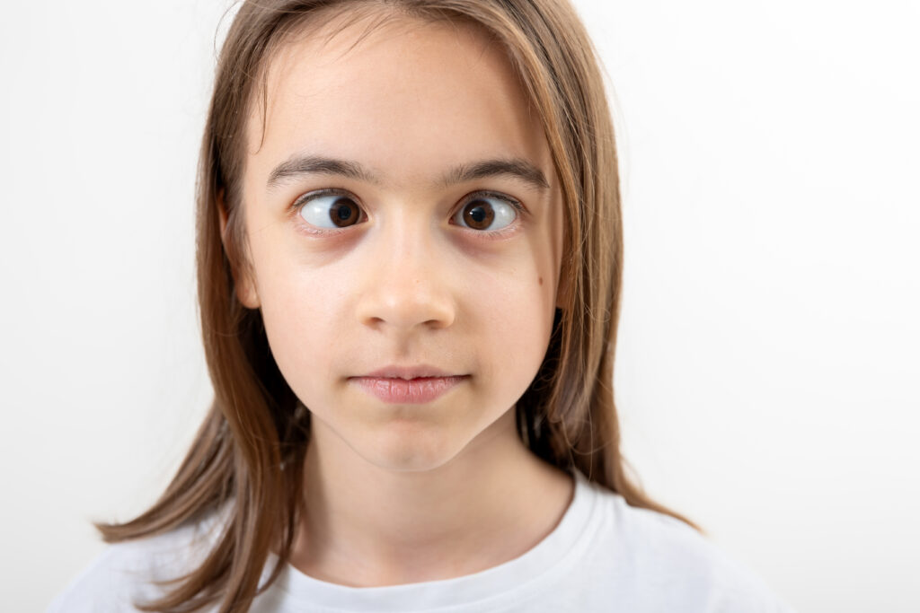 Best Squint Surgery in Raipur - Om Netra Kendra and Laser Vision