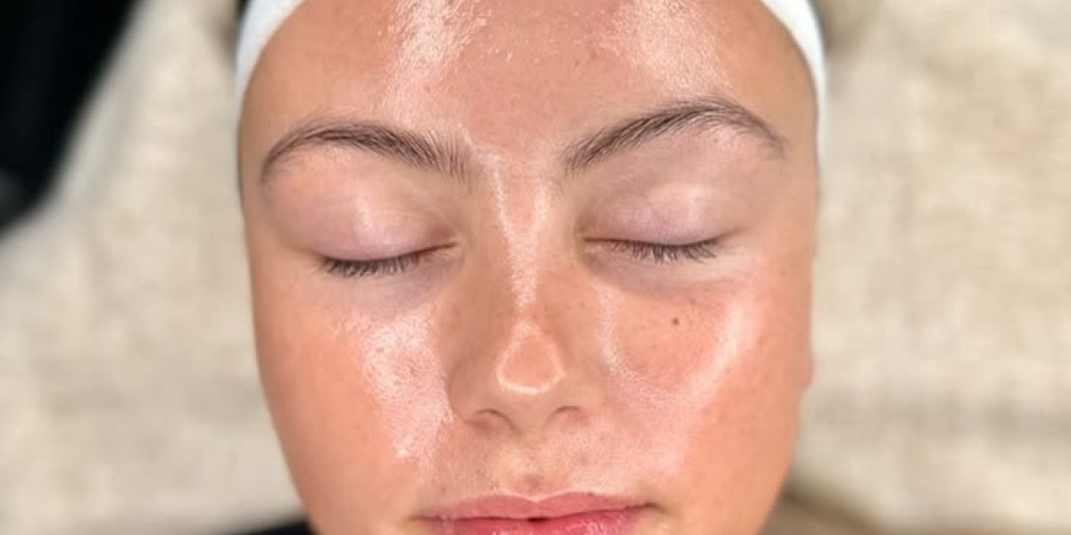 Hydrafacial in Islamabad: Revitalize Your Skin with an Advanced Facial Solution