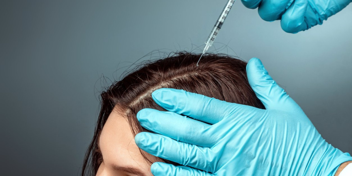 Exosomes Hair Therapy In Islamabad: Your Complete Guide to Hair Restoration