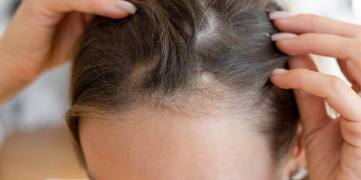 Latest Trends and Innovations in Hair Restoration in Riyadh